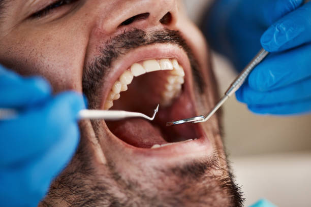 Best Chipped Tooth Repair Near Me  in Stagecoach, NV